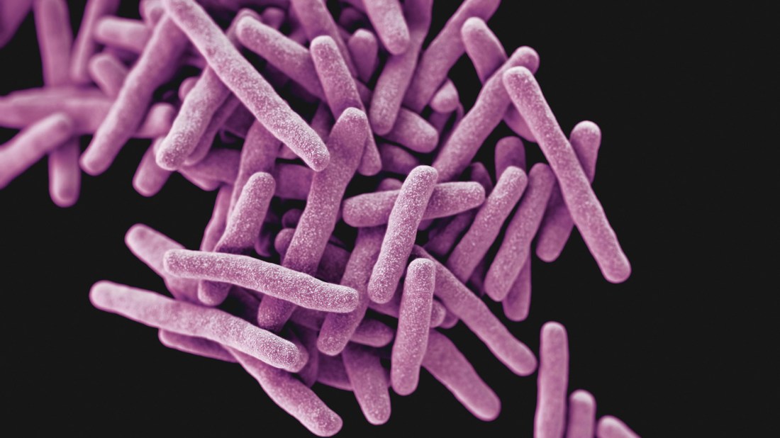 Mycobacterium tuberculosis bacteria, the pathogen responsible for causing the disease tuberculosis (TB). A 3D computer-generated image. Photo by CDC on Unsplash.